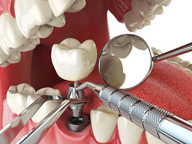 Best Emergency Dental Care for Trauma or Injury in Closter, NJ